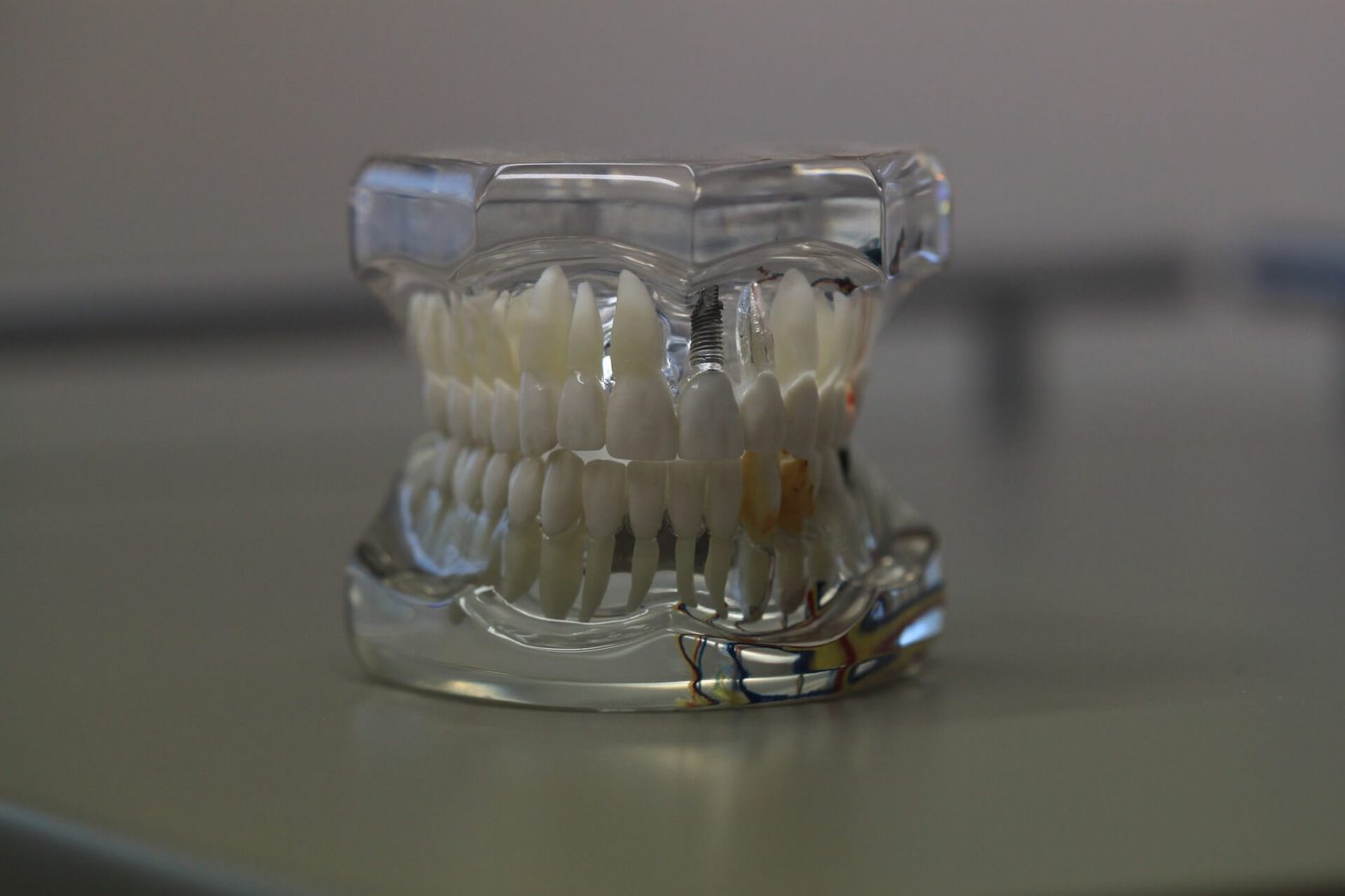 Model teeth - Mississauga Dentist - Bristol Dental