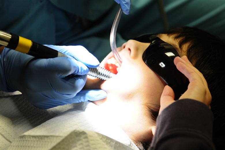 dental sealants