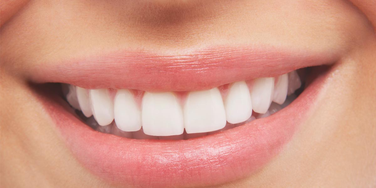 Teeth Whitening