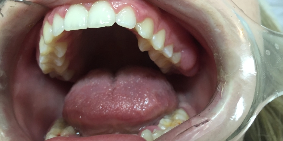 cosmetic dentistry
