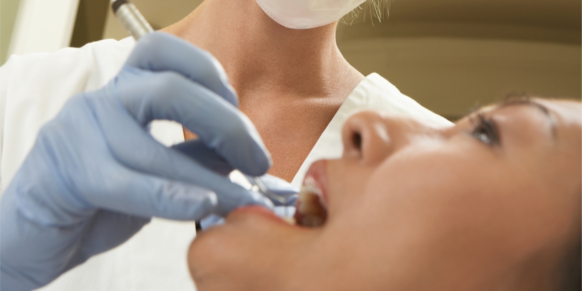 tooth extraction