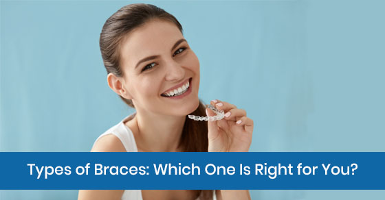 Types of Braces: Which One Is Right for You?