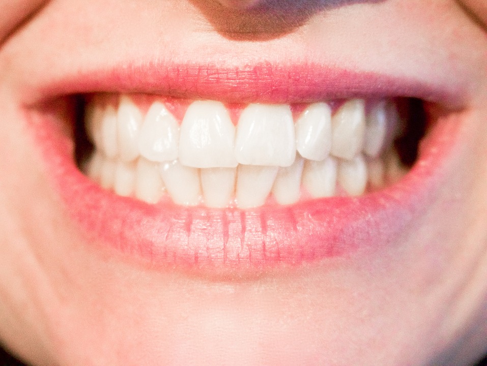 Porcelain & Composite Dental Veneers
