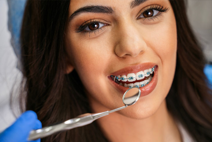 Orthodontic Treatment Mississauga